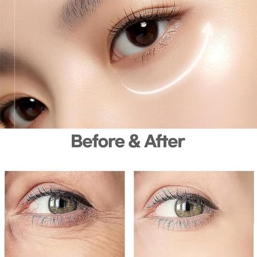 Glozie Instant Eye Lift, Eye Cream, Instant Firmx Eye Tightener, Eye Bag Remover, Eye Wrinkle Cream for Women, Anti-Aging Eye Cream, Smooth Wrinkles, Tighten Skin & Brighten Complexion - Image 3