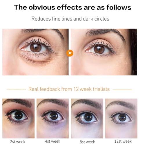 Glozie Instant Eye Lift, Instant Eye Lift, Glozie Eye Bag Eraser, Glozie Instant Firm Eye Cream, Glozie Eye Instant Eye Bag Eraser, Instant Firmx Eye Tightener, Anti-Aging Eye Cream (1 pc) - Image 4