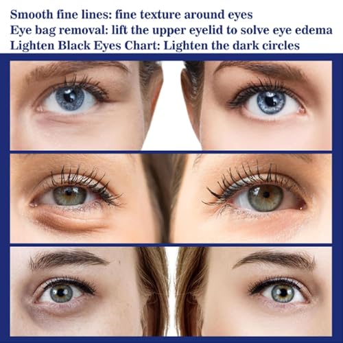 Glozie Instant Eye Lift, Instant Eye Lift, Glozie Eye Bag Eraser, Glozie Instant Firm Eye Cream, Glozie Eye Instant Eye Bag Eraser, Instant Firmx Eye Tightener, Anti-Aging Eye Cream (1 pc) - Image 6