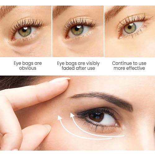 Glozie Instant Eye Lift, Instant Eye Lift, Glozie Eye Bag Eraser, Glozie Instant Firm Eye Cream, Glozie Eye Instant Eye Bag Eraser, Instant Firmx Eye Tightener, Anti-Aging Eye Cream (1 pc) - Image 3