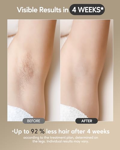 INNZA Laser Hair Removal with Ice Cooling Function for Women and Men,Painless IPL Hair Removal Device,24J High Energy Hair Removal Handset for Body Face Bikini Line Legs Armpit at-Home Use,Corded - Image 4