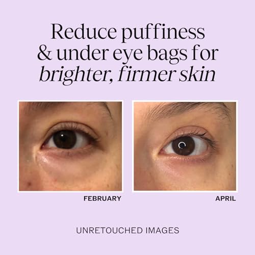 LilyAna Naturals Eye Cream for Dark Circles and Puffiness, Under Eye Cream for Wrinkles and Bags, Anti Aging Eye Cream helps Improve Dryness; for Sensitive Skin - 1.7 oz - Made in USA - Image 3