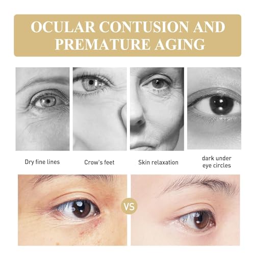 LuminEyez Collagen Anti-Wrinkle Eye Cream, Collagen Anti-Aging Eye Cream, Smooth Wrinkles,Fine Lines and Moisturizing (2 Pcs) - Image 7