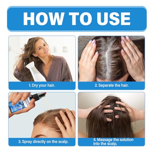 Minoxidil 5% Topical Solution Hair Growth Treatment for Men and Women, Thickens Hair, Stops Loss - Image 7