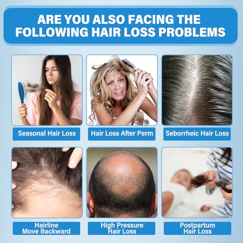Minoxidil 5% Topical Solution Hair Growth Treatment for Men and Women, Thickens Hair, Stops Loss - Image 4