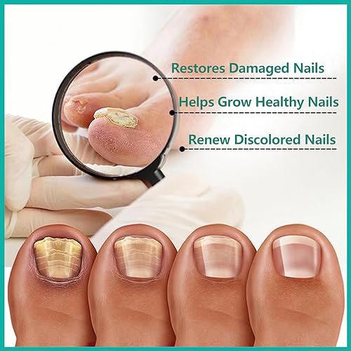 Nail Repair Cream, Nail Strengthener Cream, Nail Repair Solution, Repairs Damaged, Broken, Cracked and Discolored Nails - Image 5