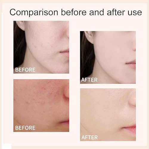 NOISSUE Perebella Cc Cream Skin Tone Adjusting CC Cream SPF 50, Cosmetics CC Cream, Colour Correcting Self Adjusting Soft Moisturizing Skin Tone Gel Invisible Pore Light Oil-Free (Natural-2pcs) - Image 5