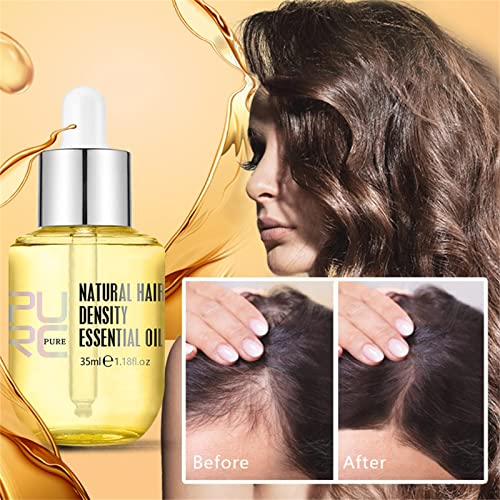 PURC Hair Density Essential Oil, PURC Oil for Hair Growth, PURC Hair Growth Essence Oil, Natural Hair Density Essential Oil (2 PCS) - Image 4