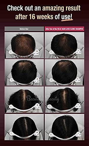 RGIII RG3 PREMIUM TREATMENT 2X RED GINSENG HAIR LOSS PREVENTION - Image 6