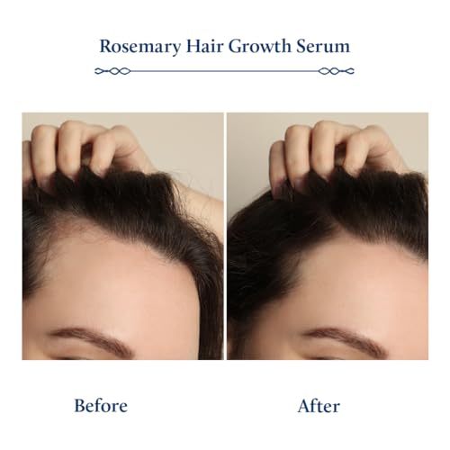 Rosemary Hair Growth Serum 3.38 Fl Oz for Thicker, Nourished Hair - Image 4