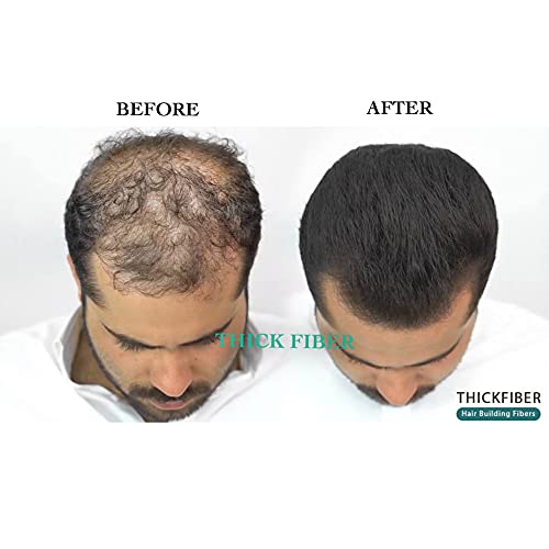 THICK FIBER Hair Fibers for Thinning Hair & Bald Spots (BLACK, Pack of 2) - 25g Bottle - Conceals Hair Loss in Seconds - Hair Powder for Women & Men - Image 4