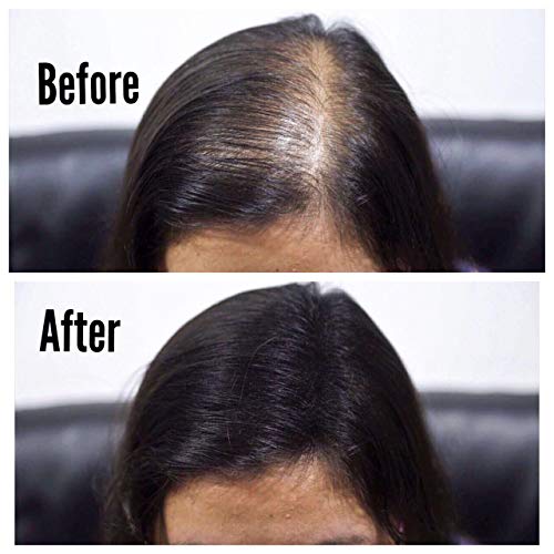 THICK FIBER Hair Fibers for Thinning Hair & Bald Spots (BLACK, Pack of 2) - 25g Bottle - Conceals Hair Loss in Seconds - Hair Powder for Women & Men - Image 3