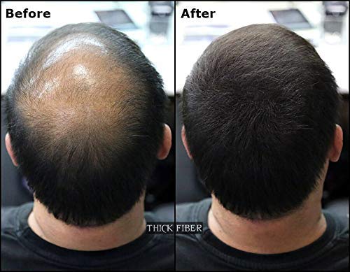 THICK FIBER Hair Fibers for Thinning Hair & Bald Spots (BLACK, Pack of 2) - 25g Bottle - Conceals Hair Loss in Seconds - Hair Powder for Women & Men - Image 6