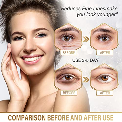 Under Eye Masks - 24K Gold Under Eye Patches for Puffy Eyes and Dark Circles - Under Eye Treatment, Fine Lines & Puffiness, 30 Pairs Collagen Eye Gel Pads for Personal Care - Image 4