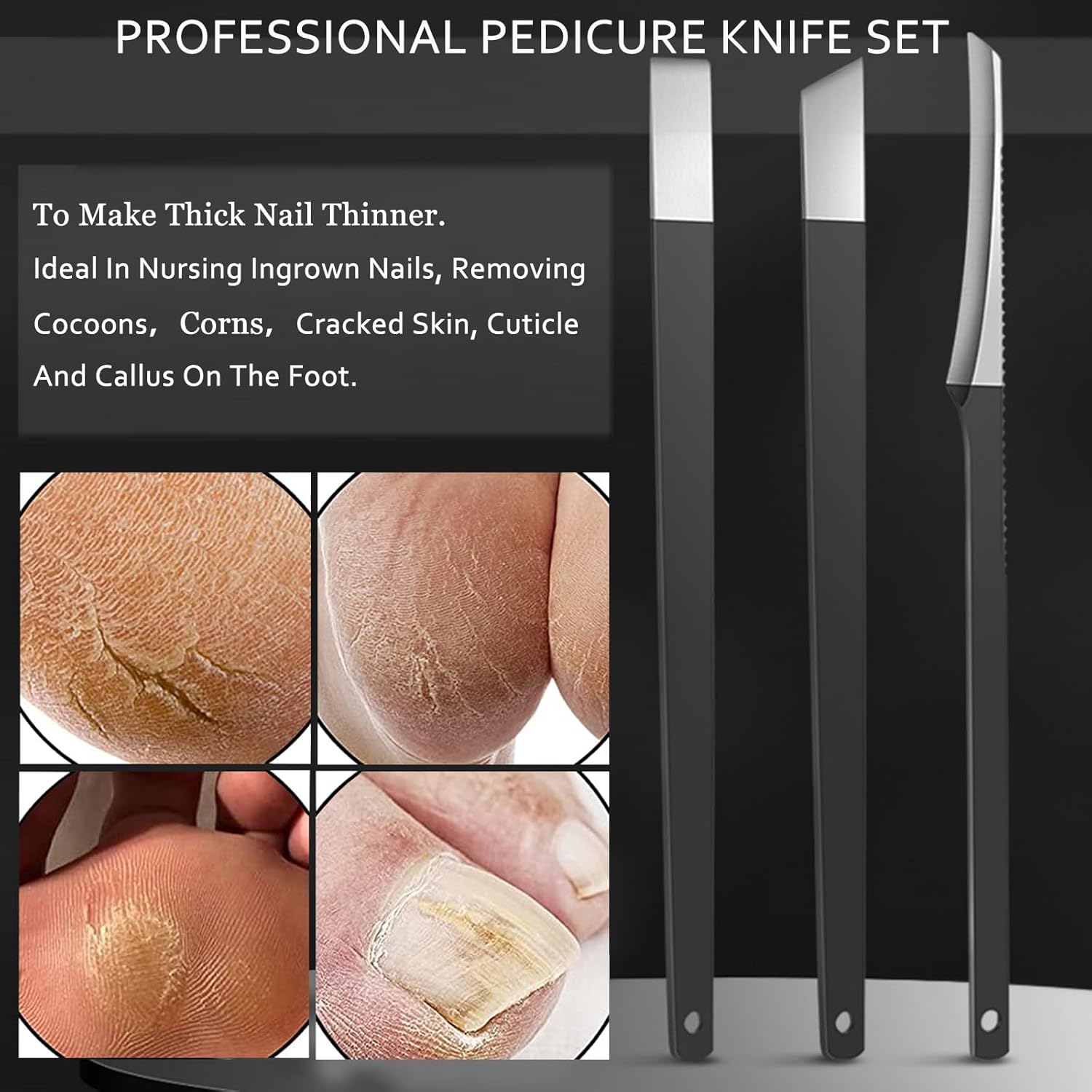 Ingrown Toenail Clipper and Callus Remover Tool for Men and Women - Image 4