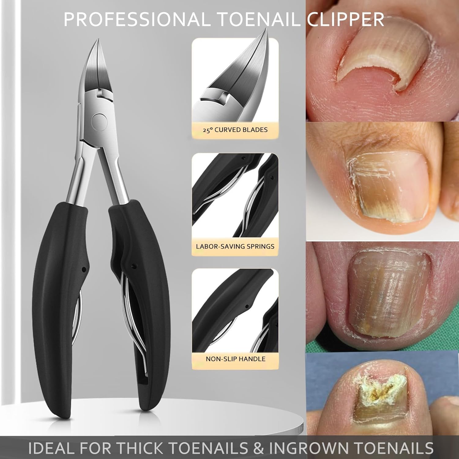 Ingrown Toenail Clipper and Callus Remover Tool for Men and Women - Image 2
