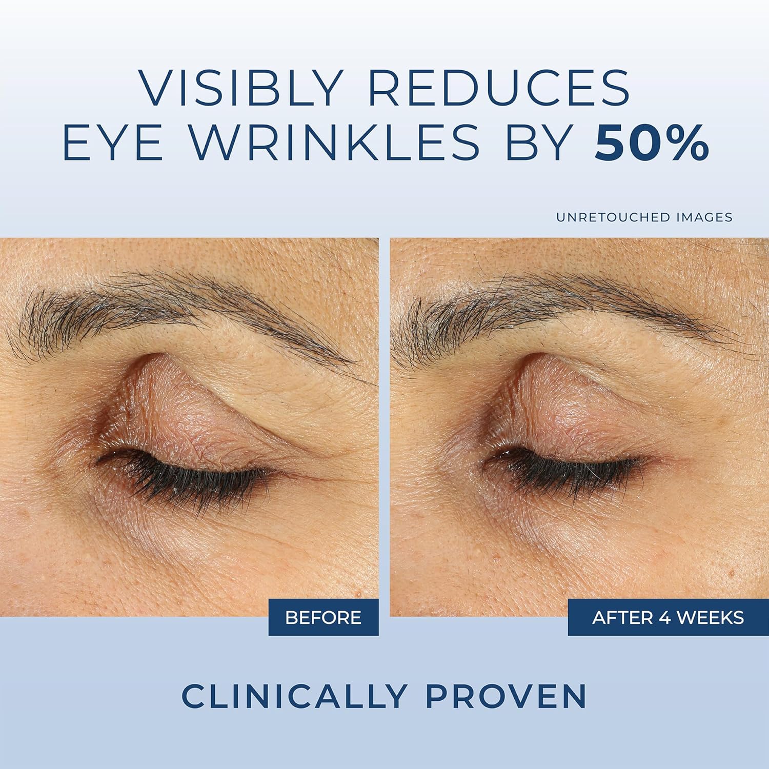 RoC Retinol Under Eye Cream for Dark Circles, Puffiness & Wrinkles, 0.5 oz - Image 4