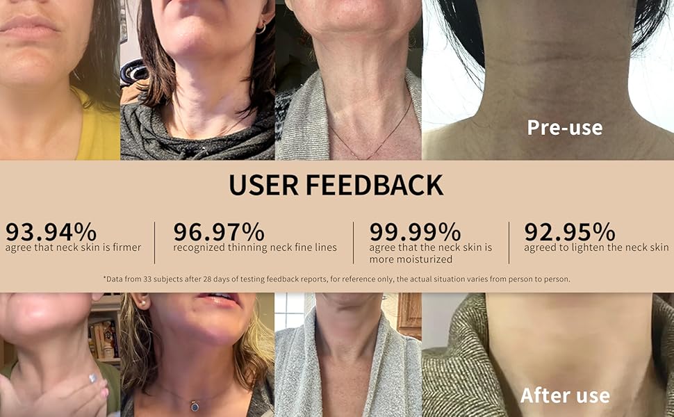 ycz ah8 firming neck cream