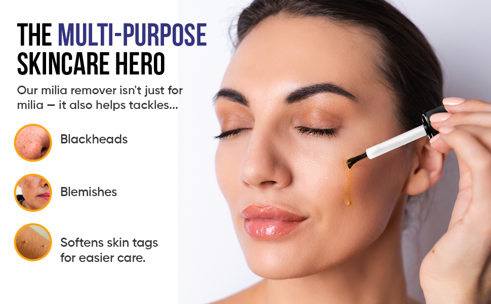 Milia Remover Helps Blackheads, Blemishes, Skin Tags