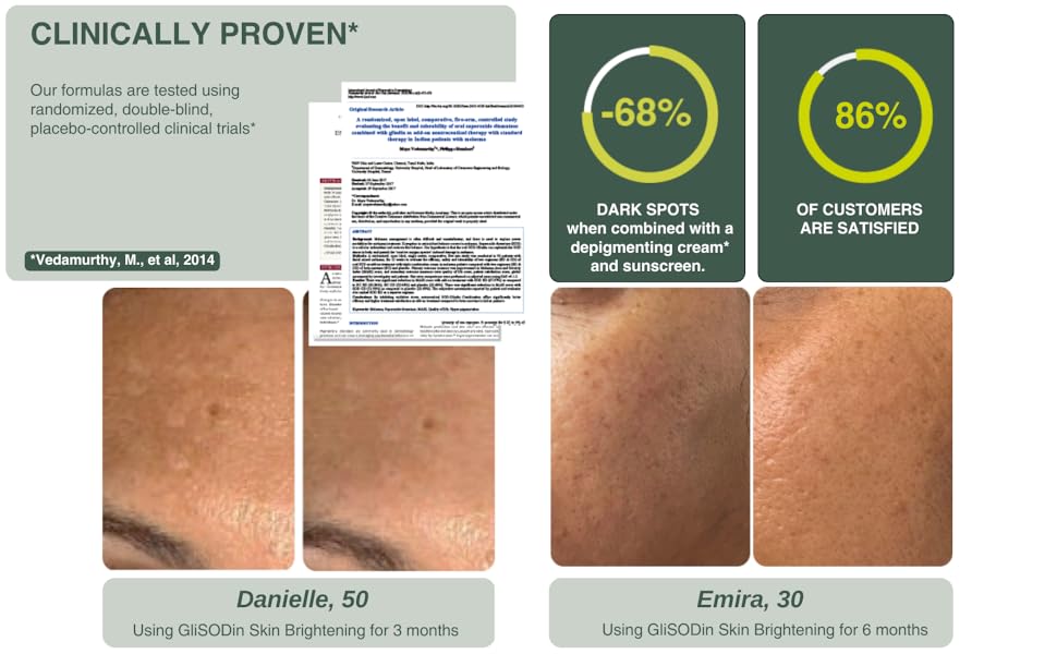Glisodin Skin brightening