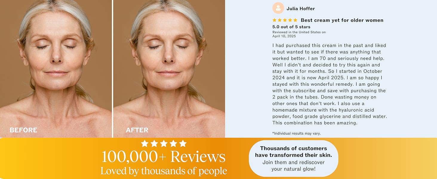 best retinol cream, 5 star reviews, most popular retinol cream