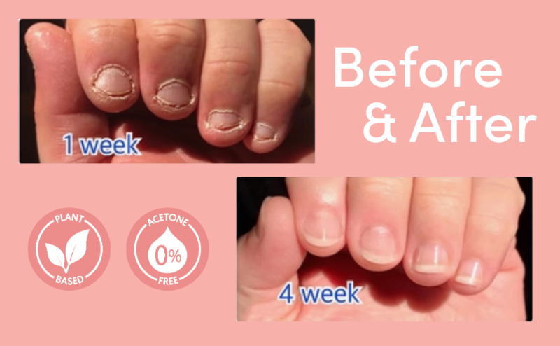 Before & After
