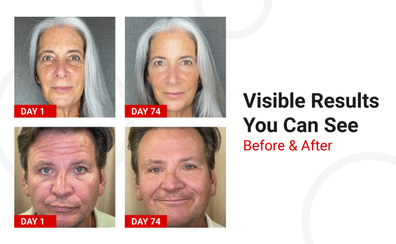 LifeCell All In One Anti Aging Cream Before and After Images
