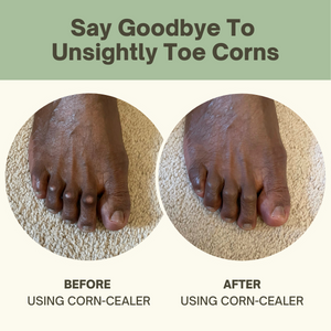 Instantly hide embarrassing toe corns