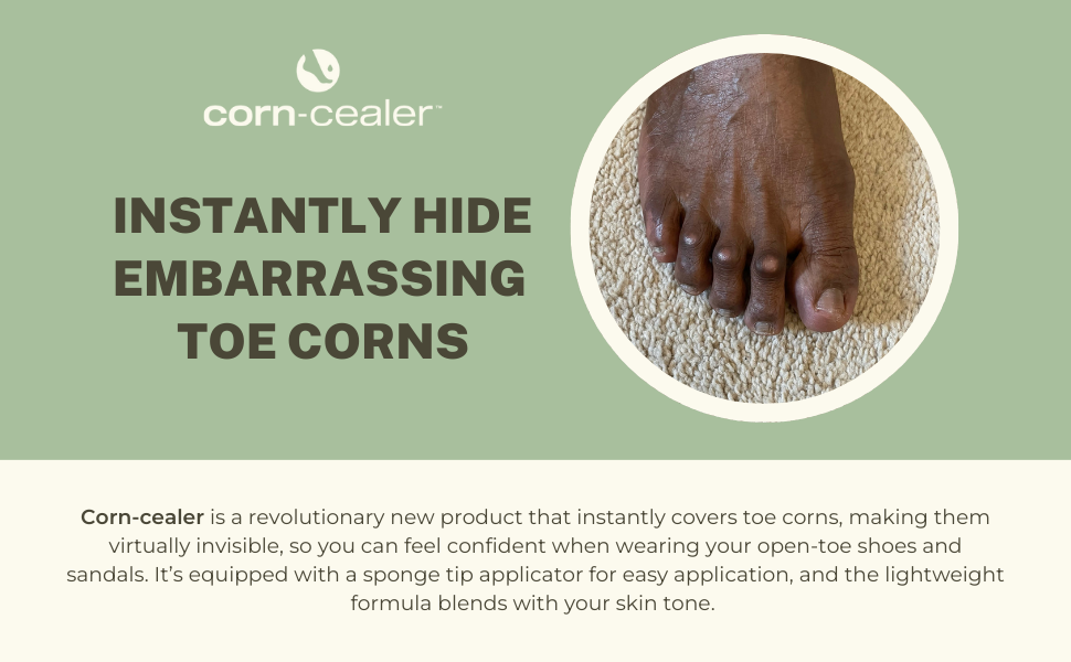 Instantly hide embarrassing toe corns