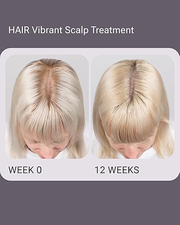 scalp serum