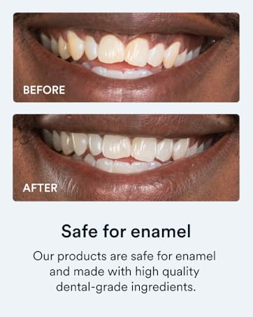 Auraglow Teeth Whitening Gel