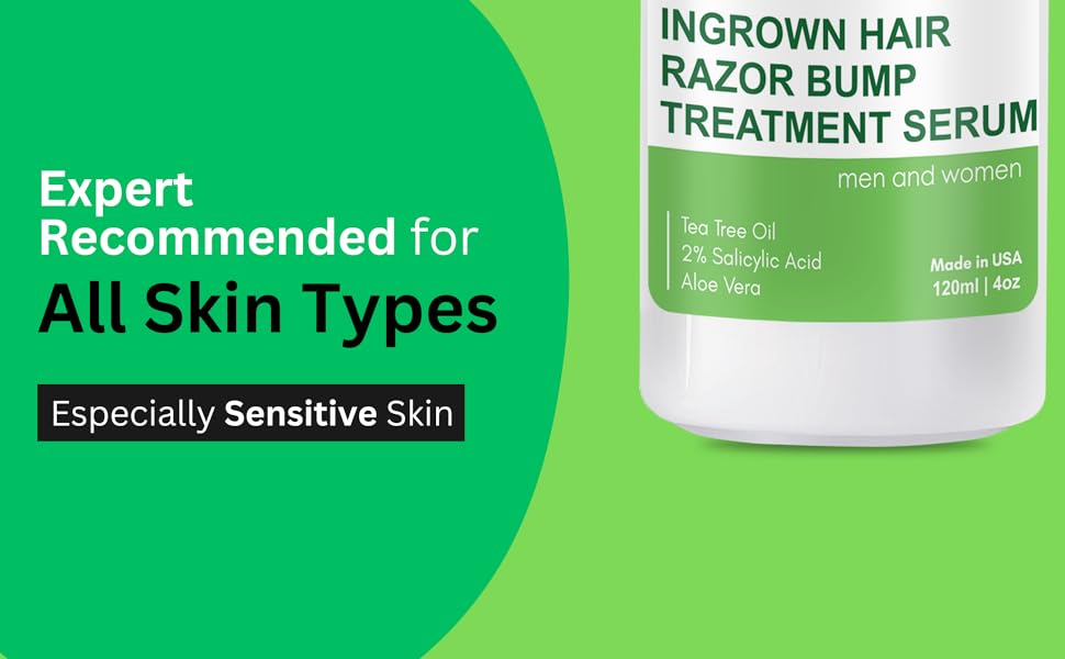 ingrown hair