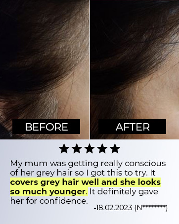 Epais Brown Hair Cover b&a