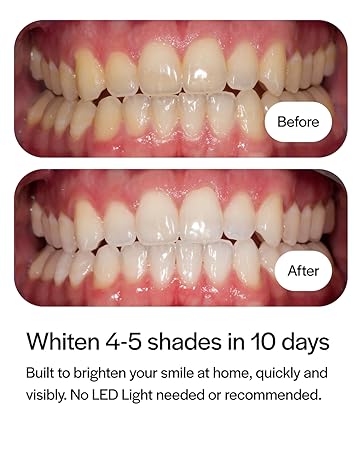 Before & After 10 Days