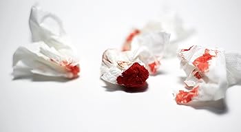 Nosebleed Issue