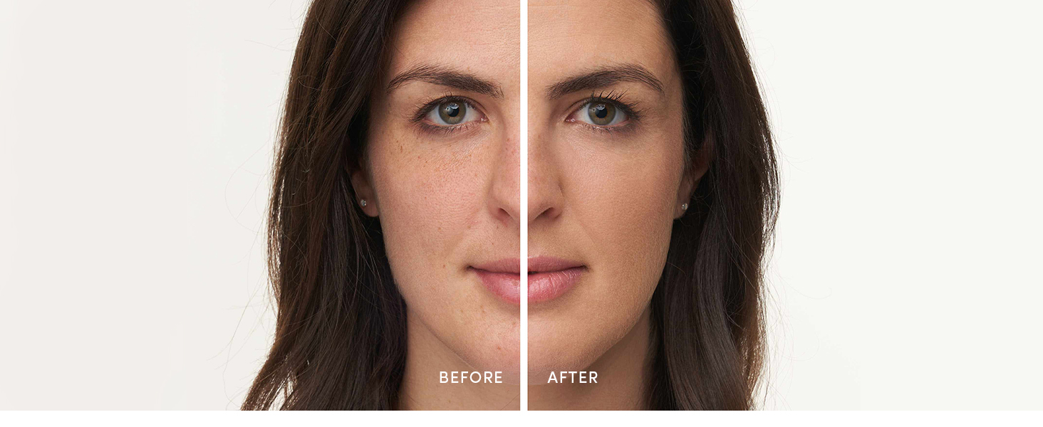 Before and After