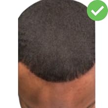 front hairline full