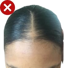 woman with thin hair line