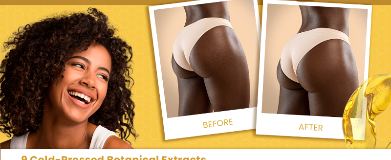 stretch mark treatment bio oil skincare oil gisou rosehip oil vitamin e oil for scars stretch mark