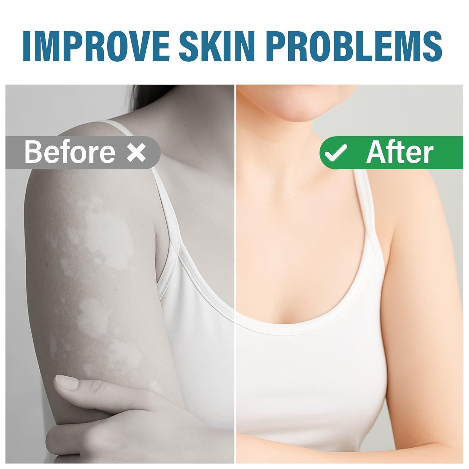 MOSKILA Vitiligo Treatment, Effective Vitiligo Cream for Skin Vitiligo, Reduce White Spots on Face or Body, Improves for Skin Pigmentation, Suitable for All Men and Women - Image 5