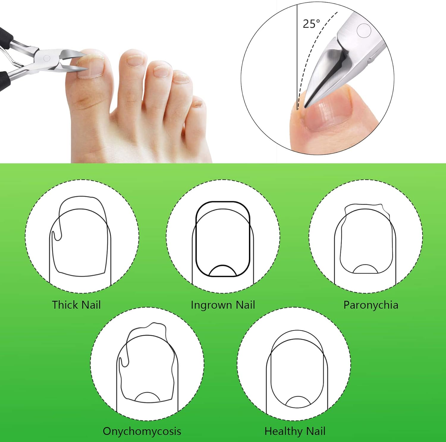 Heavy Duty Ingrown Toenail Clippers, Professional Toenails Trimmer, Podiatrist Toe Nail Clippers for Thick Nail & Ingrown Toenails, Sharp Curved Blade, Pedicure Tools. - Image 5