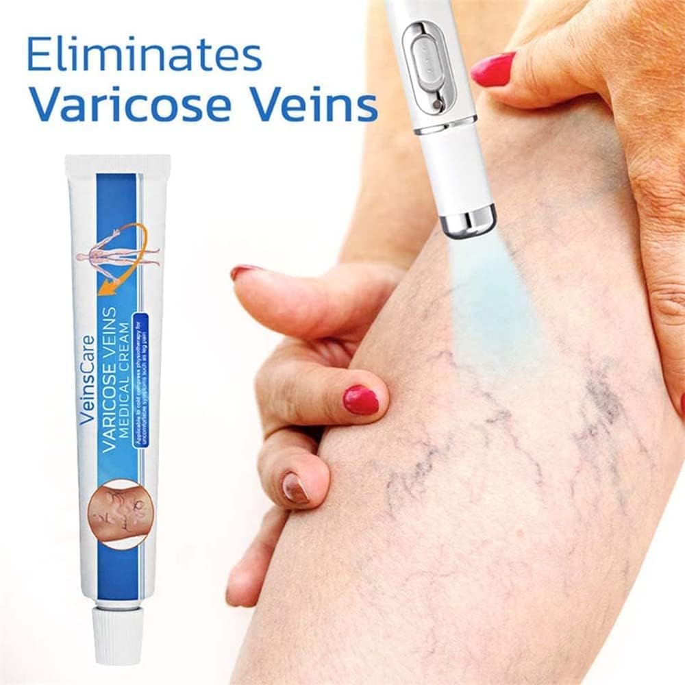 Vericose Veins Treatment Blue Light Lazer Treatment Pen,Spider Vein Treatment for Legs,Varicose Veins Blue Light Therapy Set - Image 6