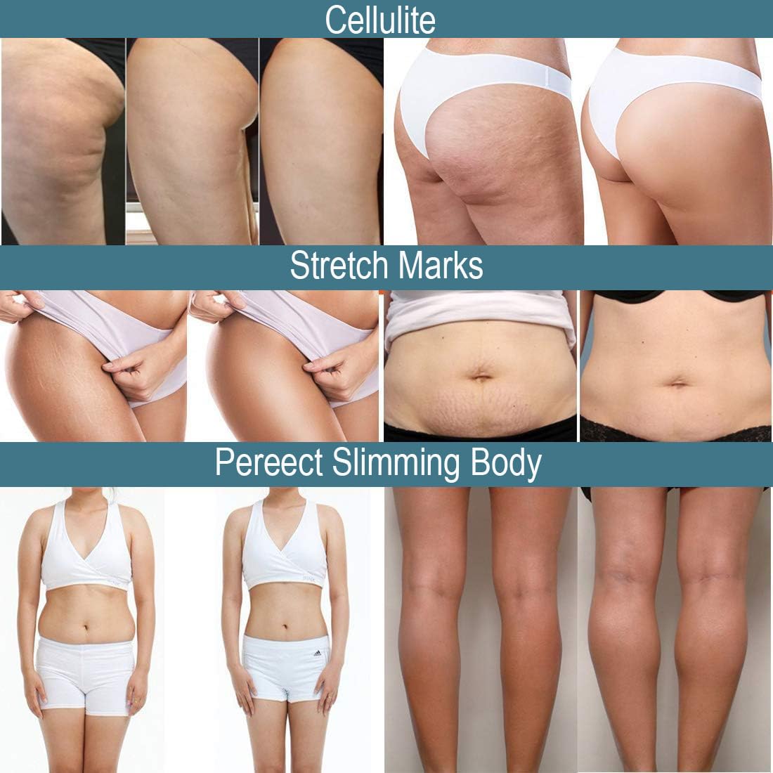 CRYOACTIVE SLIM GEL, Body Contour Gel for Firmer Skin, Anti-cellulite for Men & Women, Tightening Gel for Tummy, HIPS and Buttocks - Image 4