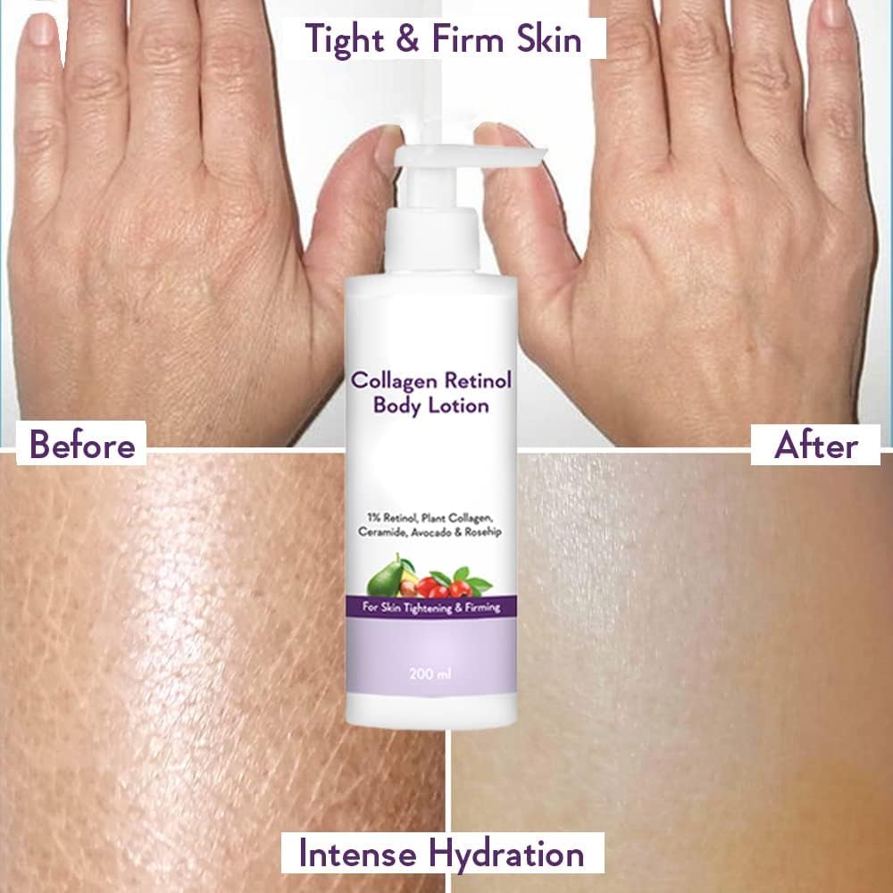 MU Collagen 1% Retinol Body Lotion - for Skin Tightening & Firming - with Niacinamide, Ceramide, Rosehip & Avocado - for Men & Women - 200 Ml - Image 4