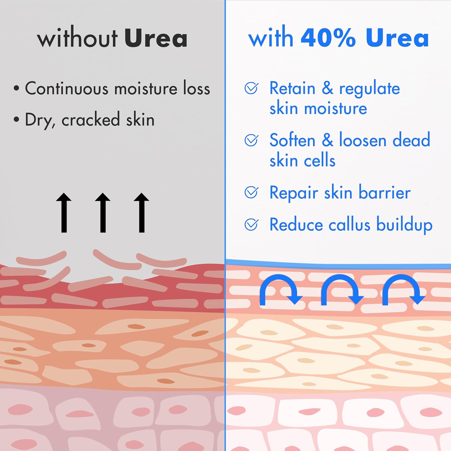 Ebanel Urea Cream 40% plus Salicylic Acid 2%, Foot Cream for Dry Cracked Heels Feet Knees Elbows Hands, Foot Dead Skin Cuticle Callus Remover Toenail Softener, Keratolytic Skin Barrier Repair - Image 5