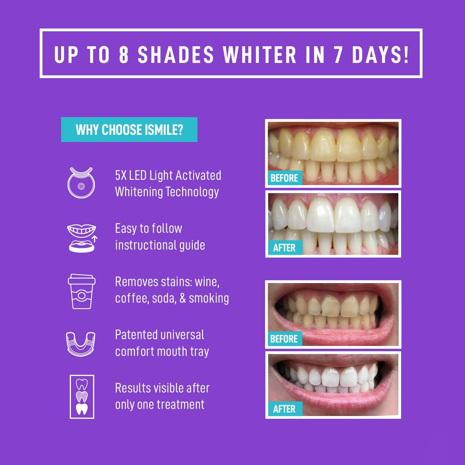 iSmile Teeth Whitening Kit - LED Light, 35% Carbamide Peroxide, (3) 3ml Gel Syringes, (1) Remineralization Gel, and Tray. - Image 2