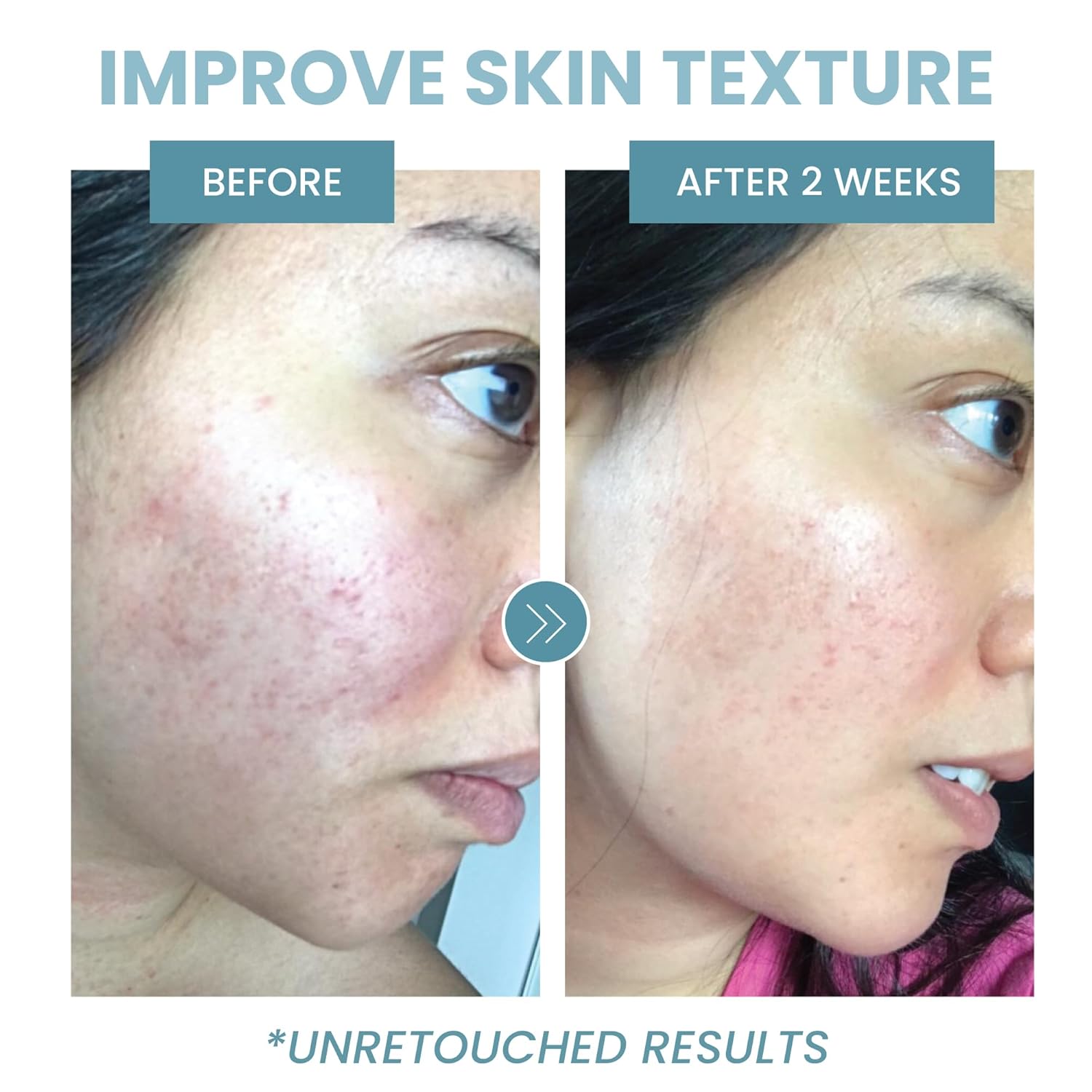 Collagen Peptide Face Serum 1 Oz Anti Aging Treatment with Hyaluronic Acid - Image 2