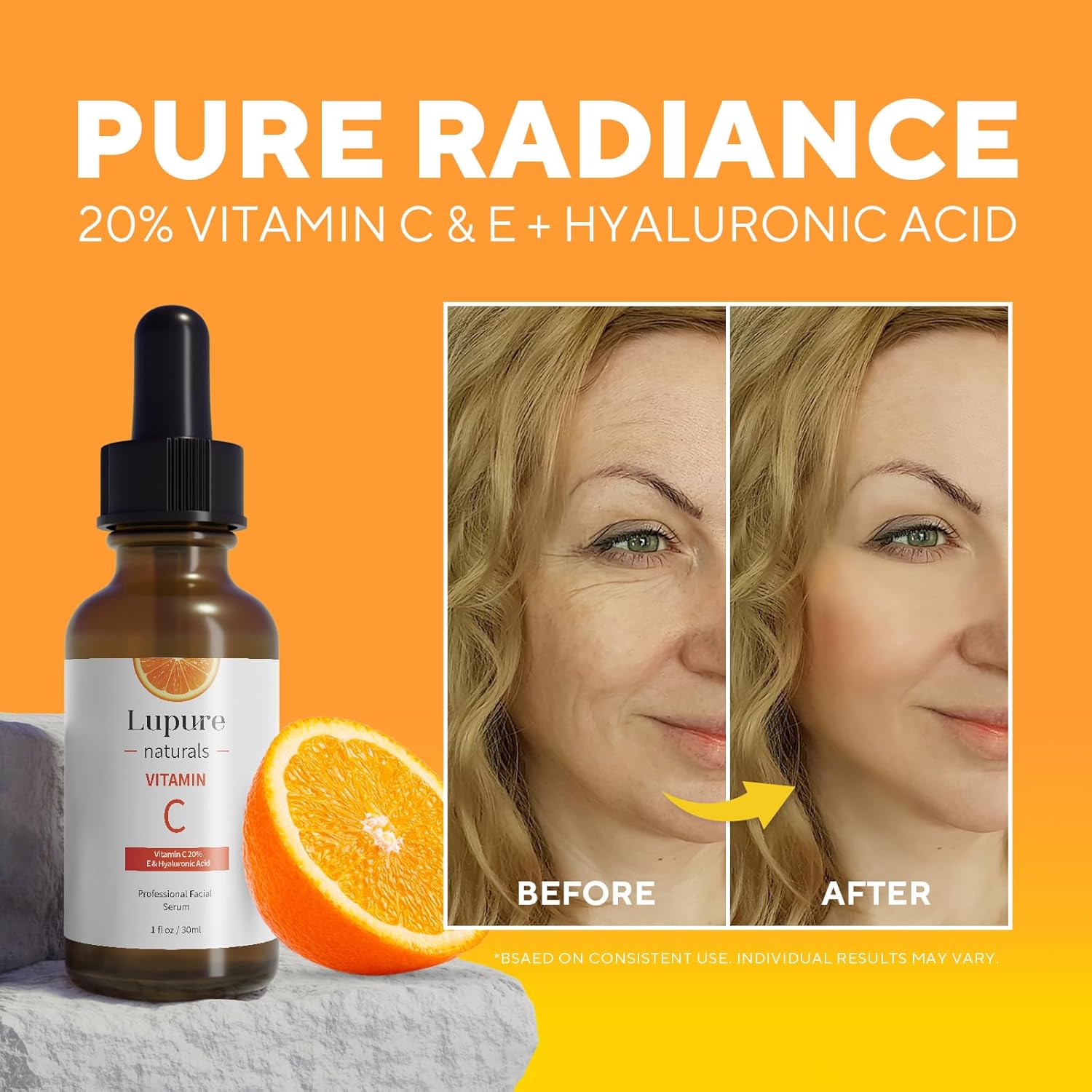 Brightening Vitamin C Face Serum 20% with Hyaluronic Acid & Vitamin E for Anti-Aging, 1 Fl Oz - Image 2