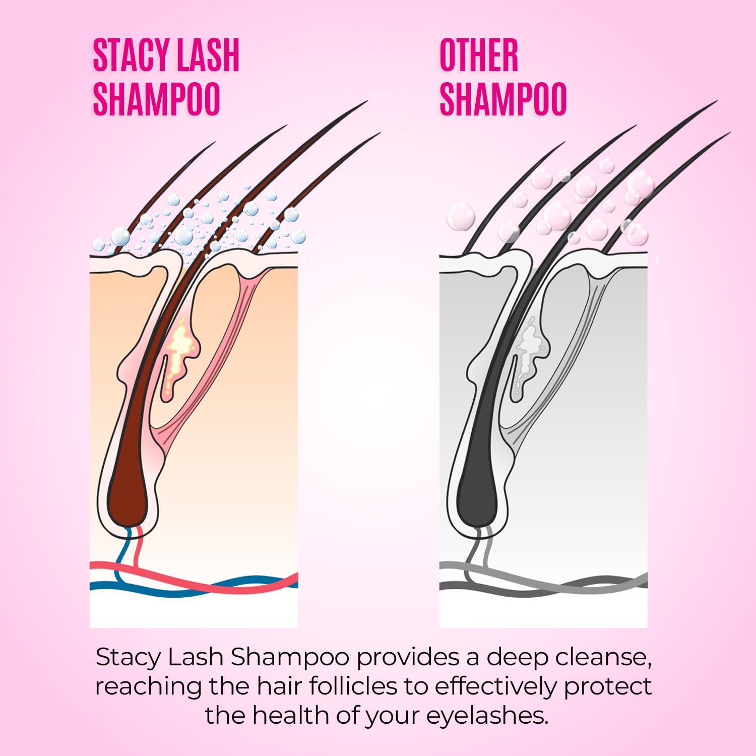 STACY LASH Lash Shampoo Kit Foaming Cleanser with Eye Lash Spoolies & Rinse Bottle & Cleansing Pad & Brush for Eyelash Extensions & Clusters & Natural Eyelashes - Image 7