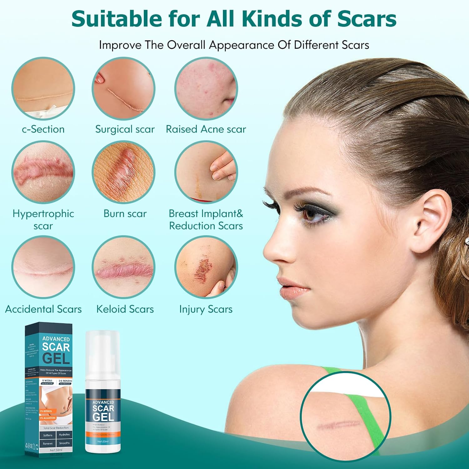 Advanced Scar Gel Cream for Surgical Scars, Burns, Acne, Stretch Marks, 1.76oz - Image 3